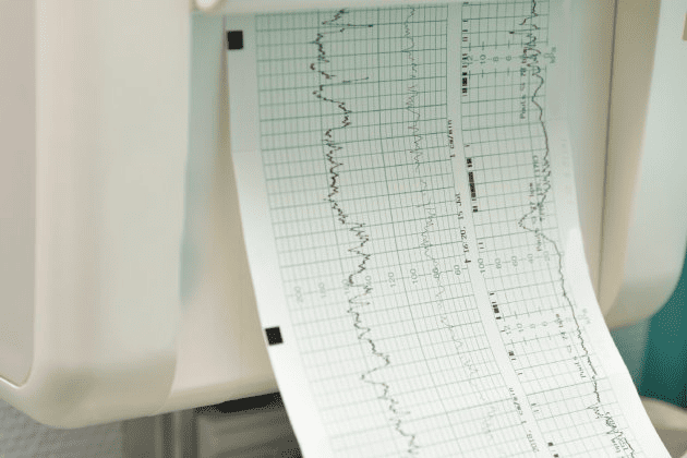 Toma de electrocardiograma